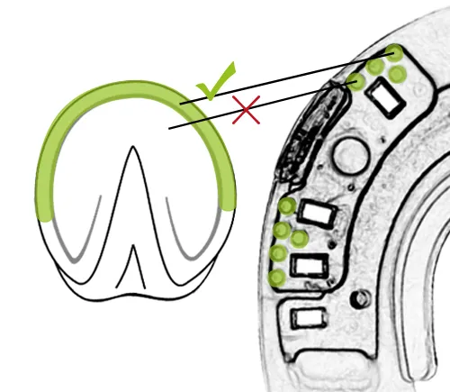 The knobs on the hoof side of the horseshoe must be placed on the bearing edge, not in the sensitive sole area.