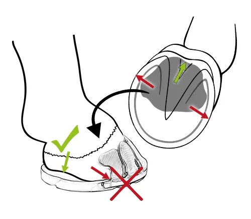 WARNING: Excess padding material may only protrude in the heel area and must not extend sideways into the bonding surface on the hoof.